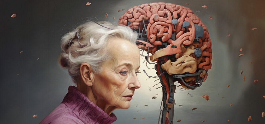 Alzheimer Hastalığı Evreleri: İlerleyiş ve Belirgin Aşamalar